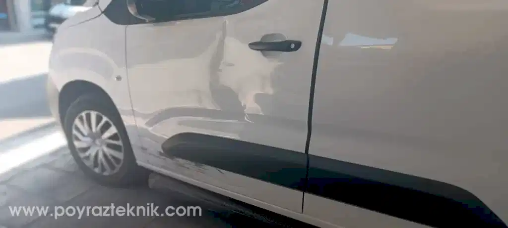 Boyasız Göçük Düzeltme Nedir