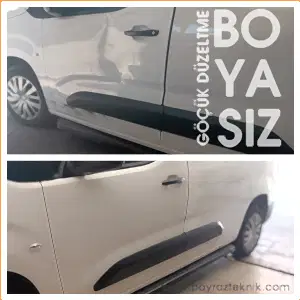 boyasiz-gocuk-duzeltme (1)